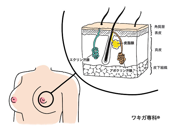 ワキガチチガが匂う原因イラスト更年期